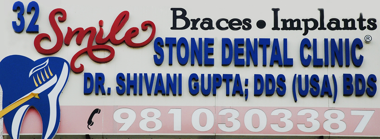 Dental Clinic in New Delhi - 32 Smile Stone Dental Clinic