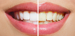 cosmetic dentist in Delhi